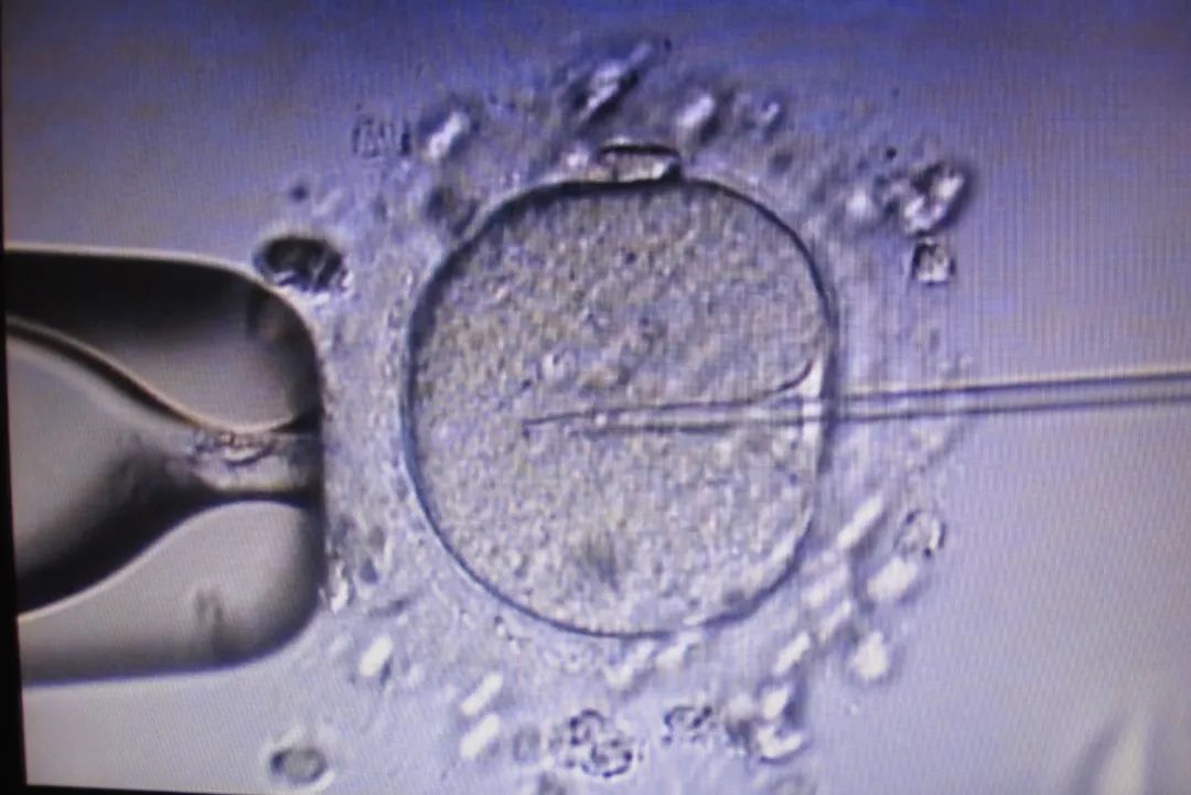 为什么可利用胚胎数常常少于获卵数？