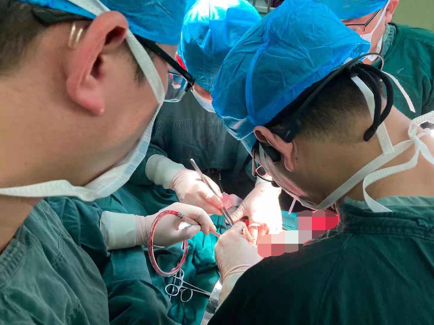 河南信合医院成功施行首例胰十二指肠切除术