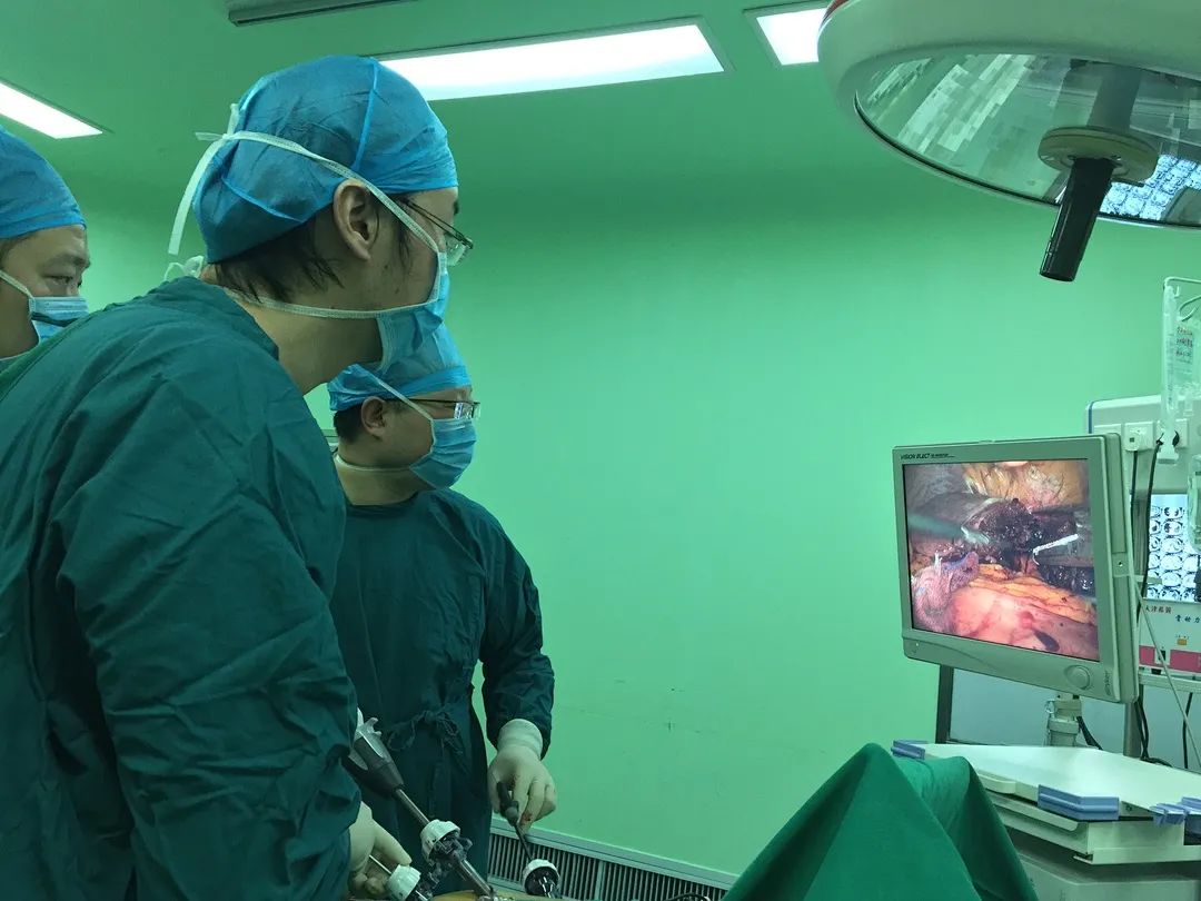 宜昌市第二人民医院：微创手术切除半边肝脏，切口仅 5 厘米