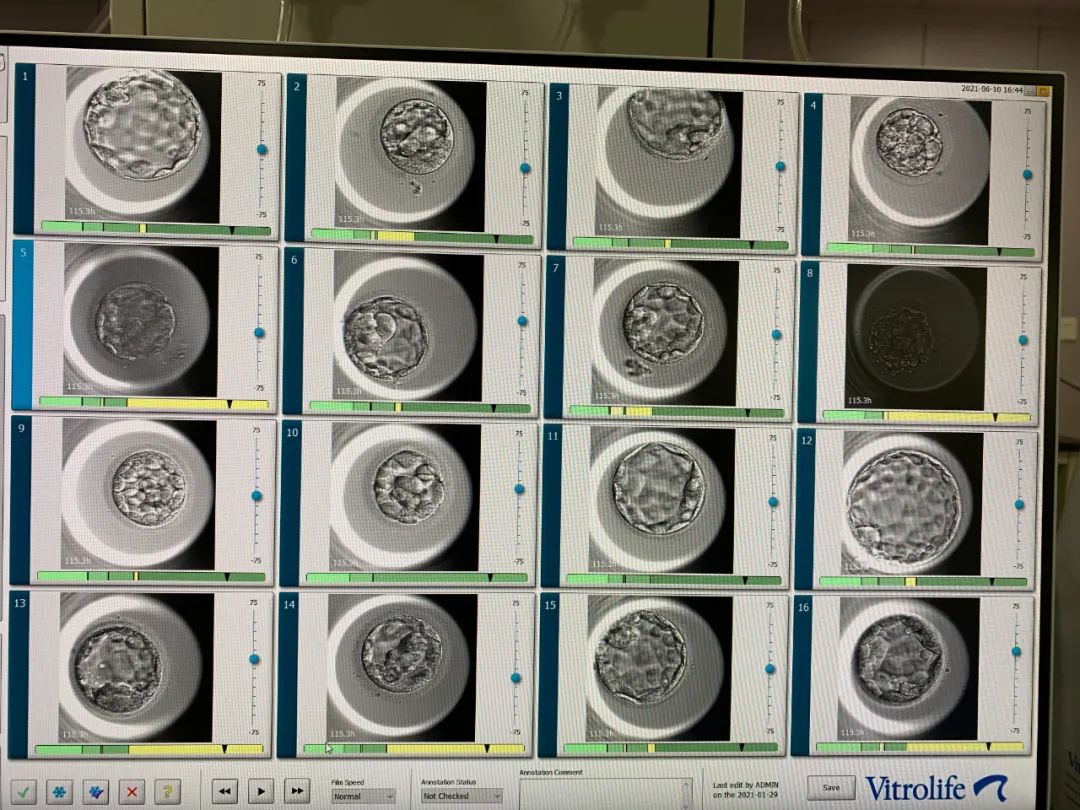 重庆北部妇产医院胚胎培育系统，试管婴儿「成功秘技」