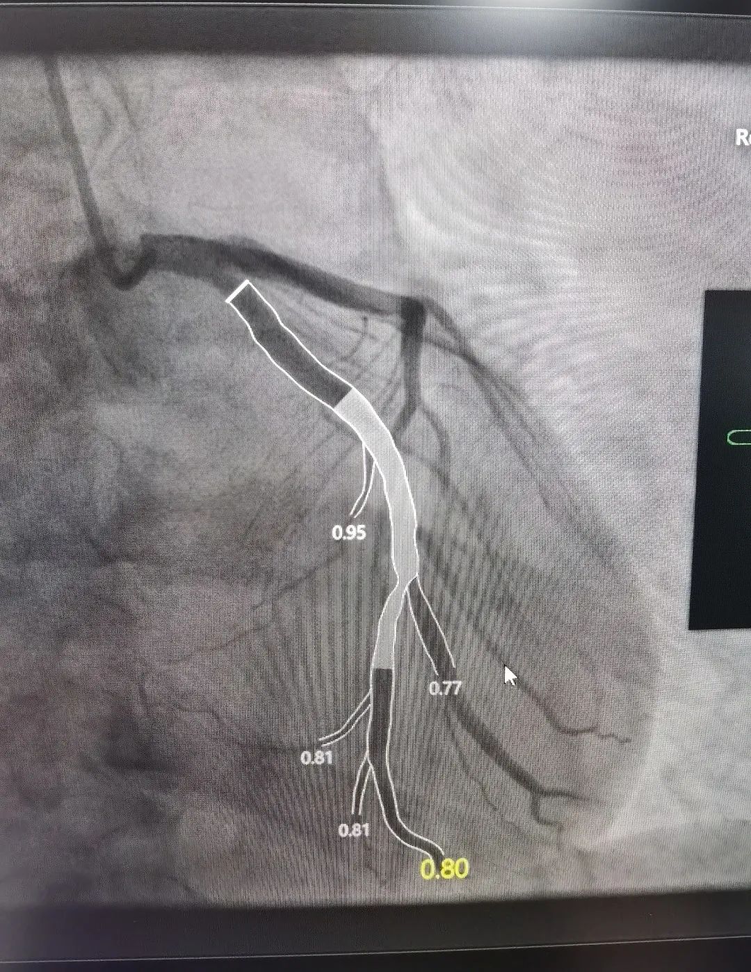 湖州市中心医院:砥砺奋进,书写学科发展「心」篇章