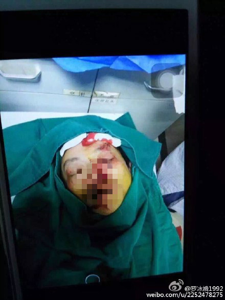 重庆市一外科主任值班时被砍致毁容、肺破裂