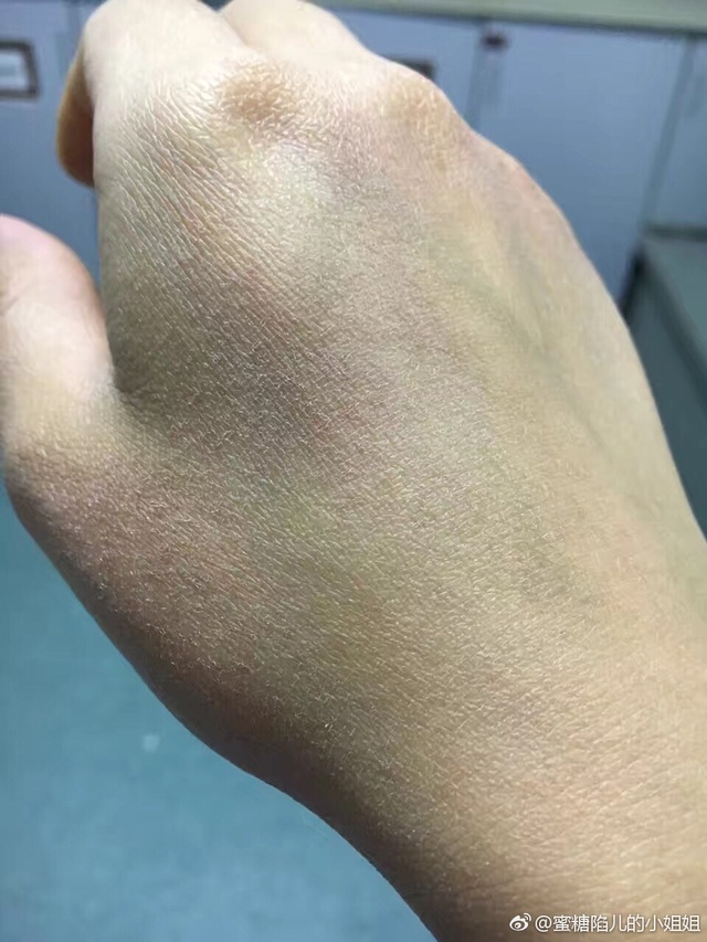 有一种名片，叫护士的手