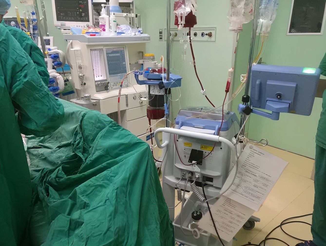 高难度挑战：江门市中心医院开展江门首例体外循环下肺癌根治术
