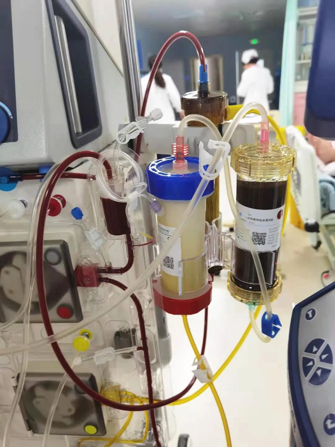 陕西省首例！西安高新医院为重症患者实施 ECMO 串联 DPMAS 治疗