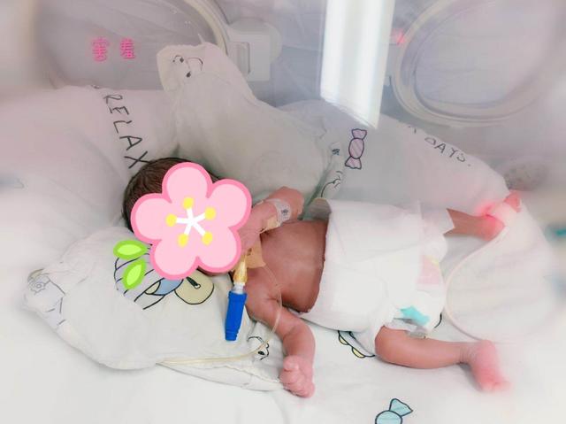 28 周早产儿身患 19 种疾病  新生儿科用爱织就「生命之网」
