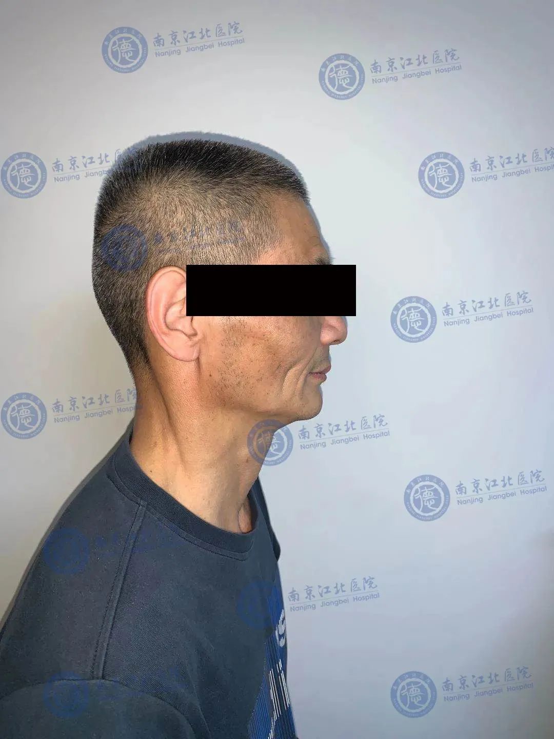 南京江北医院口腔科助力患者重拾笑容和年轻