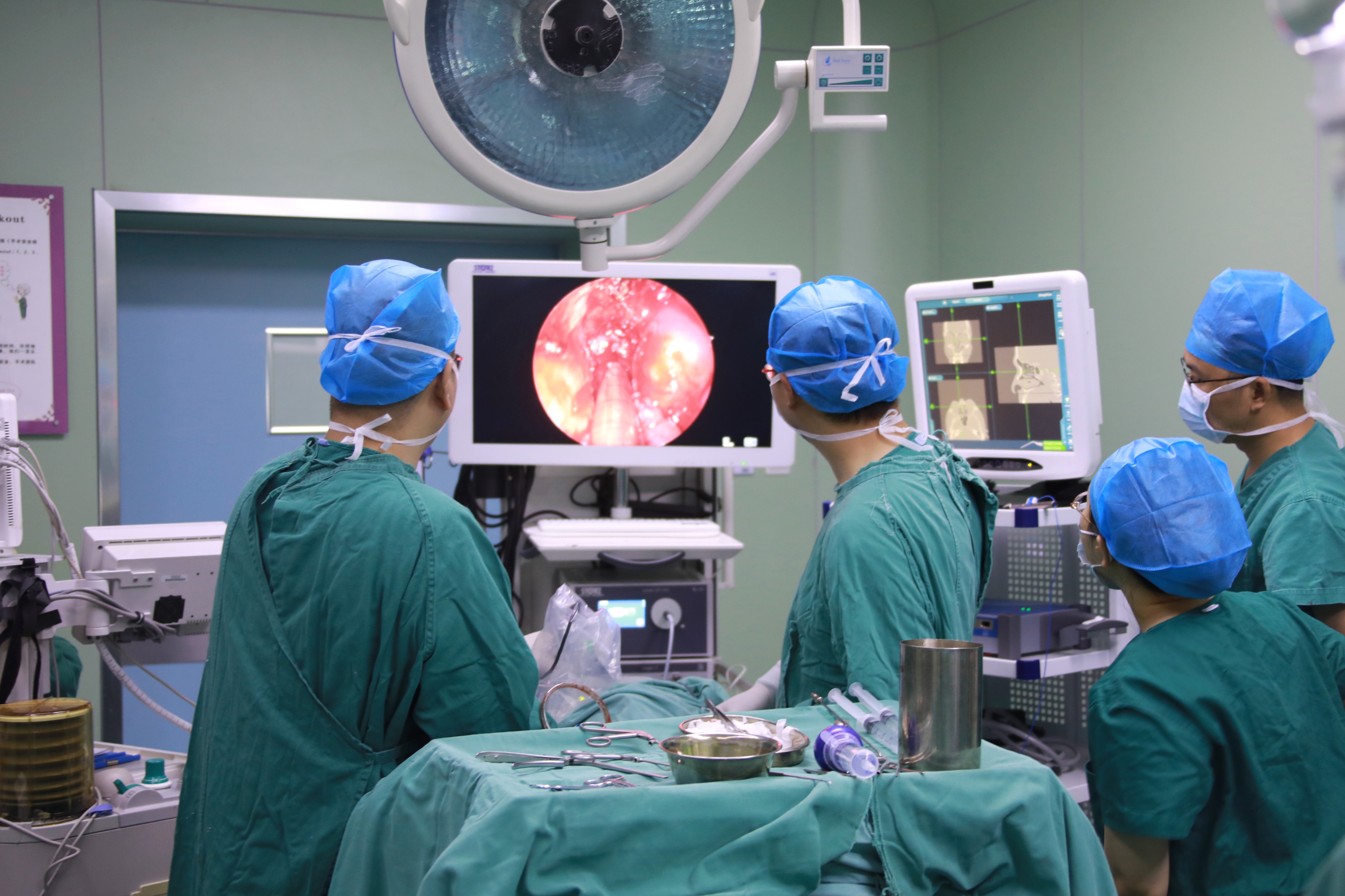 科刘锋教授指导华西广安医院完成广安市首例鼻内镜下前颅底脑膜瘤手术