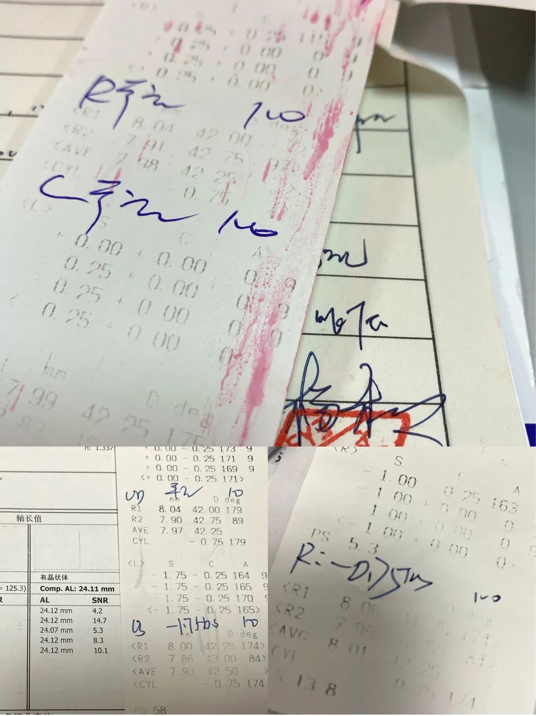 沈阳爱尔角膜塑形镜会员活动 —专家互动科普讲座
