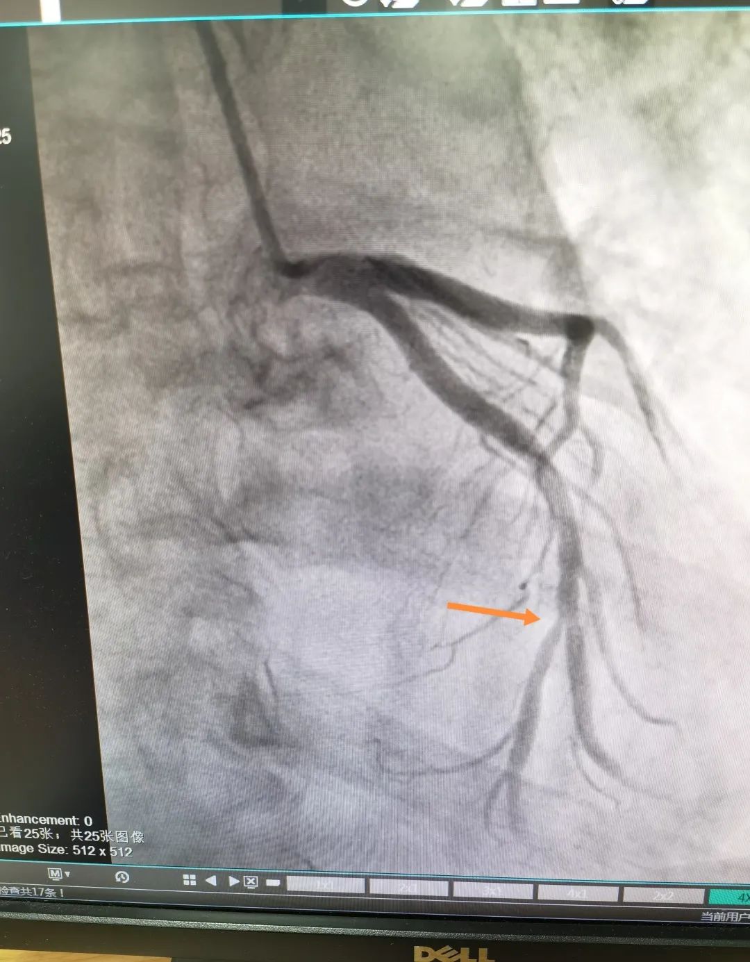 湖州市中心医院:砥砺奋进,书写学科发展「心」篇章