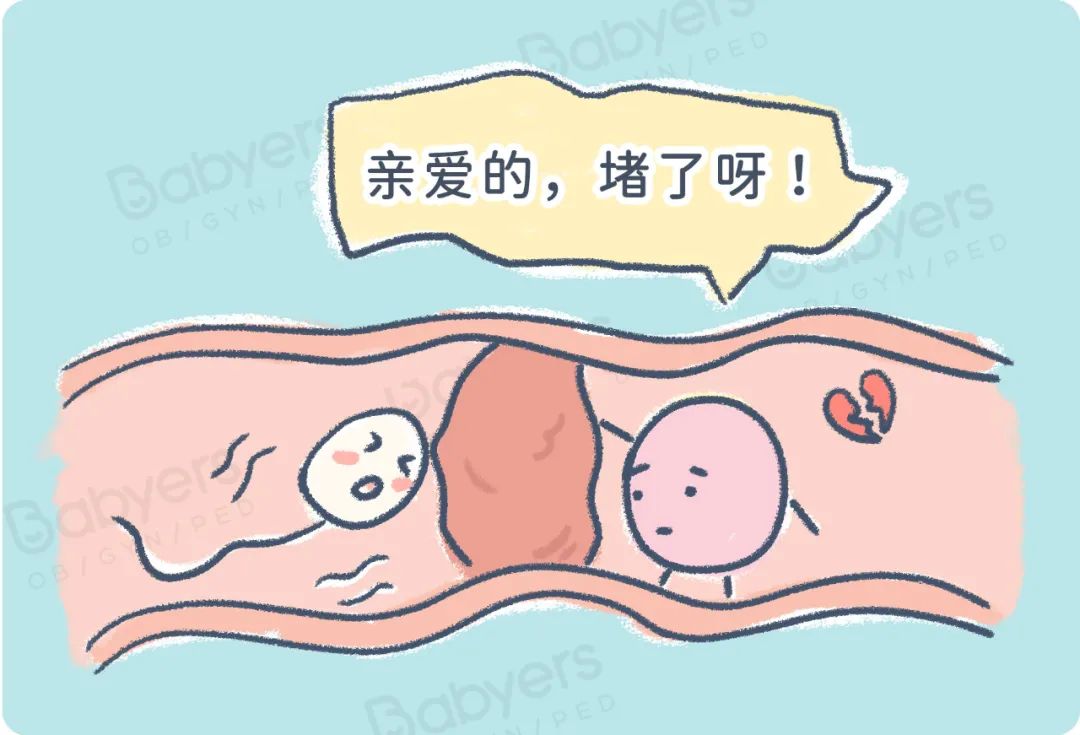 杭州贝瑞斯美华妇儿医院：精子的 N 种死法！干死、酸死、累死……最后一个最悲惨！
