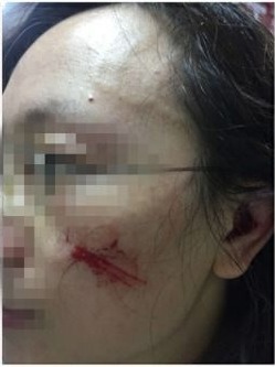 湘潭：药监局公务员殴打医生致脑震荡 怀孕 7 个月医生被打住院