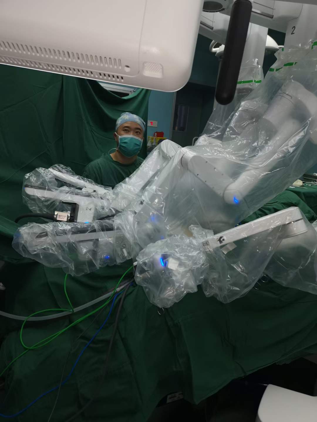 南昌大学二附院泌尿外科胡红林教授团队完成一例机器人辅助腹腔镜膀胱癌根治术