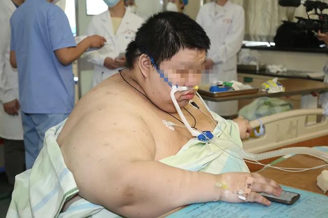 疫情期间暴增 200 斤，556 斤武汉「第一胖」送医保命
