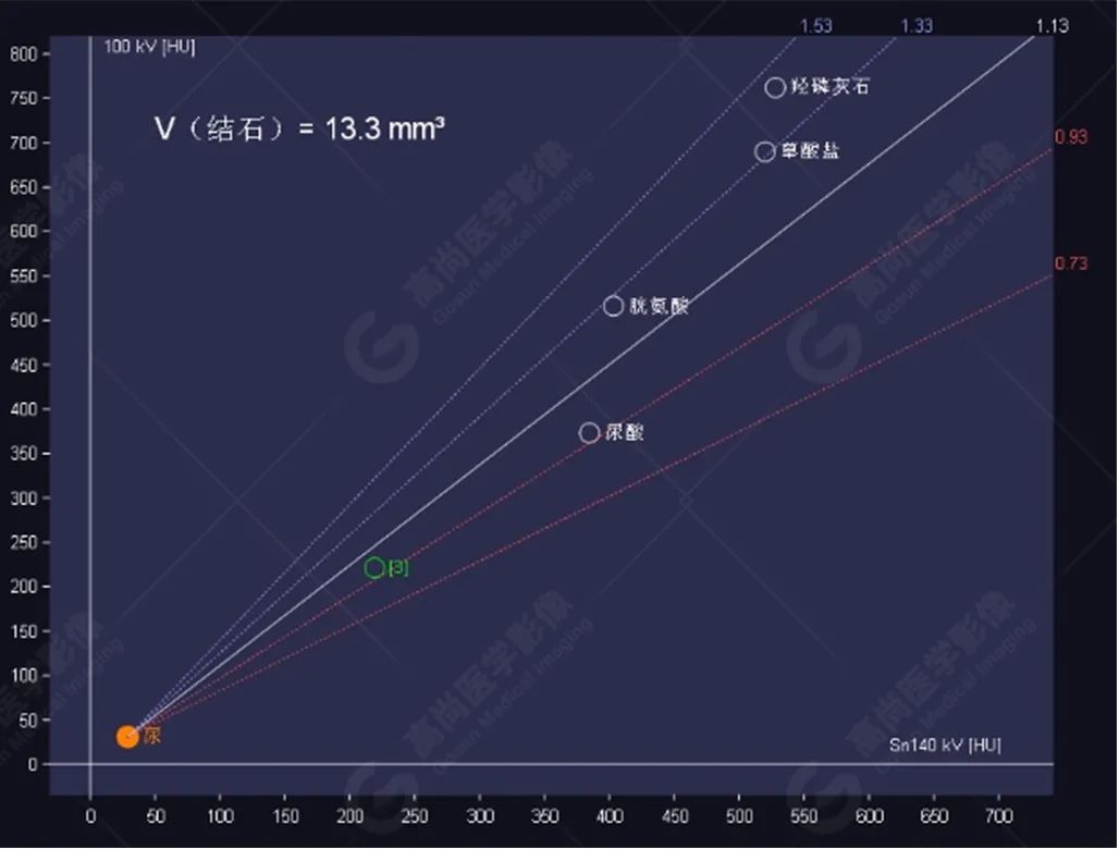 高尚病例:双能量 CT 成像分析泌尿系结石成分