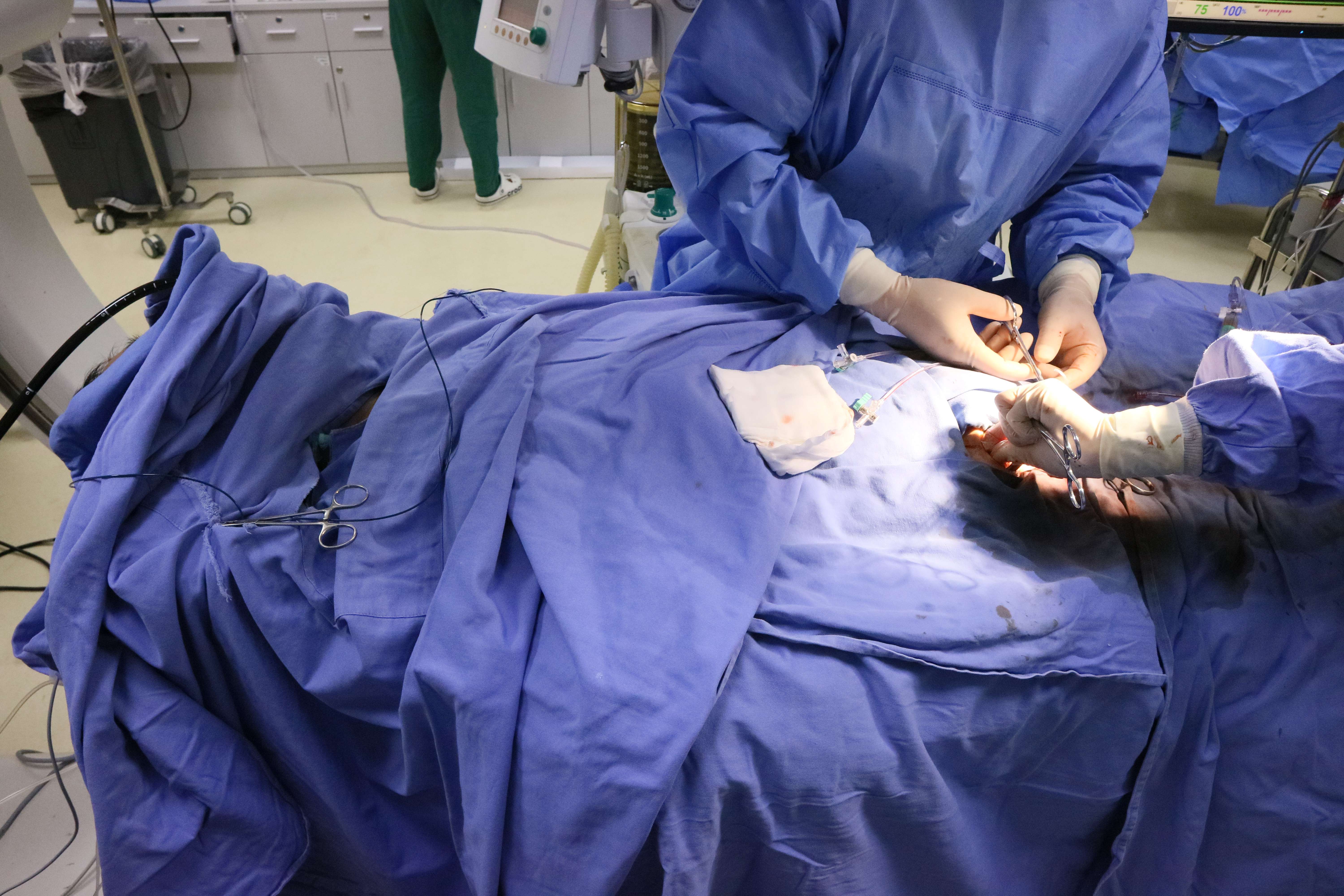 上海市第一人民医院多科室合作救治一腹主动脉瘤破裂患者