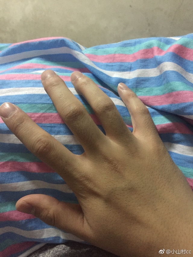 有一种名片，叫护士的手