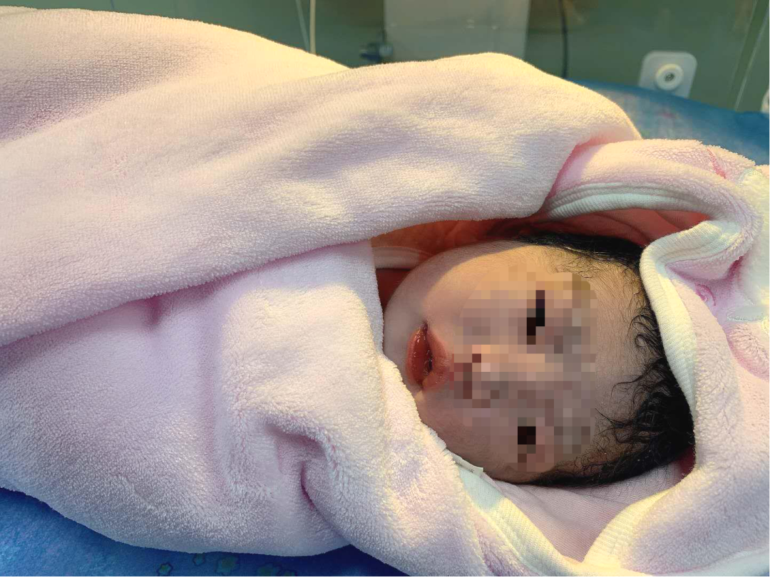 前海人寿广州总医院产科首例瘢痕子宫阴道分娩，疤痕子宫孕妈顺利实现「二胎顺产」梦