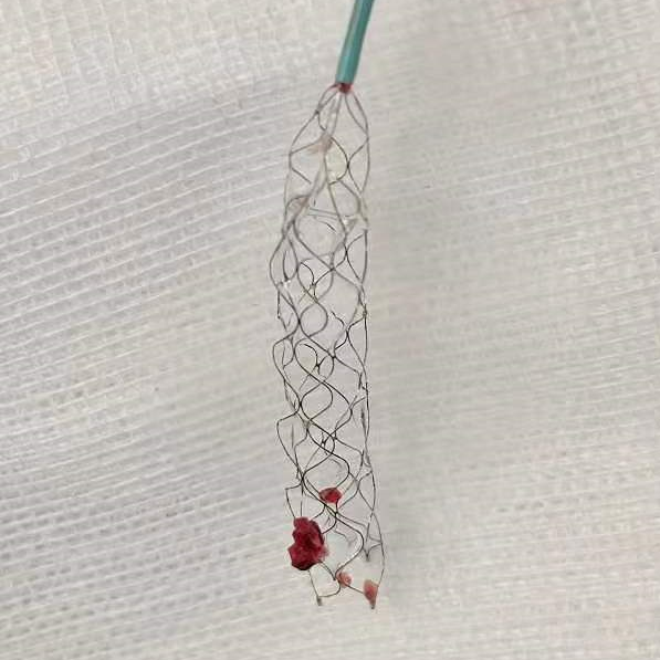 重度中风，致残率高达 75%，7 旬老人却成功逃过偏瘫、失语后遗症