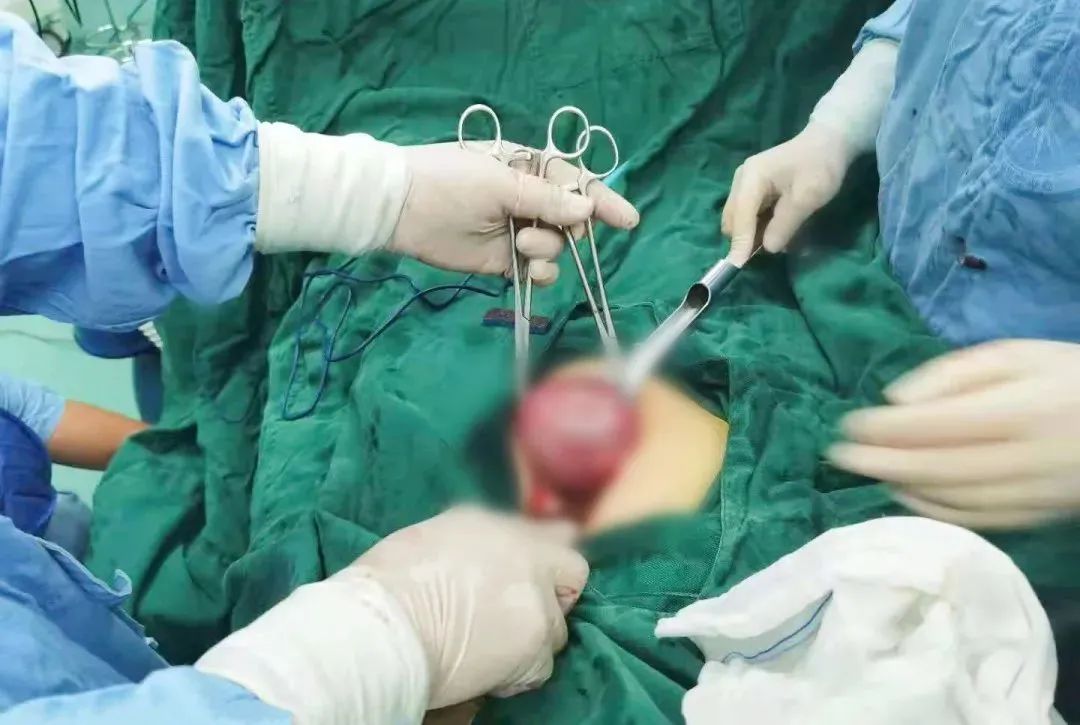 一台必胜的手术：每一位患者都值得我们全力以赴