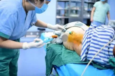 变「痛点」为亮点，重庆市璧山区人民医院麻醉科创新 ERCP 麻醉方式