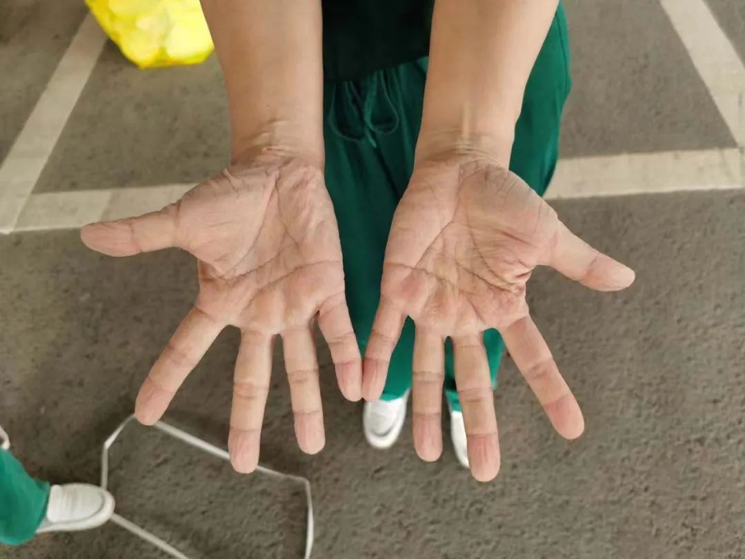 再获央媒报道点赞!华厦眼科医护团队用行动诠释战疫「最美身影」