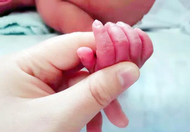 西安交大一附院成功救治西北最小胎龄双胞胎试管婴儿