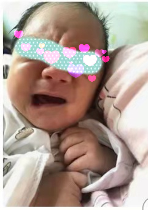江西省儿童医院：宝宝哭泣时表情搞怪，这种疾病了解一下