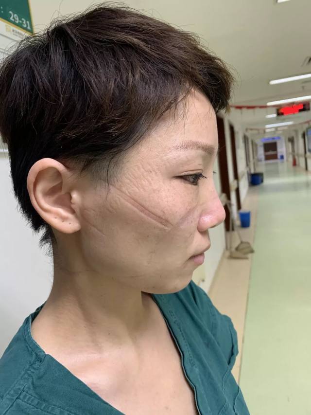 上海杨浦区中心医院 SARS「老兵」再战武汉「新冠」