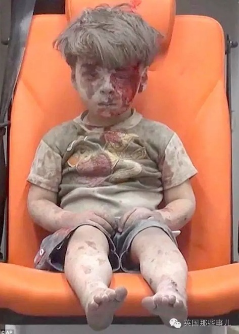 战火中的儿童：为什么他如此茫然？