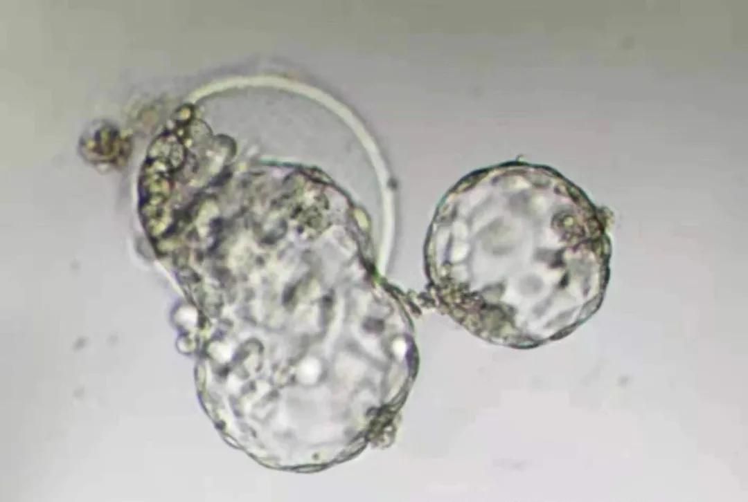 以一变二！显微镜下捕捉到正在分裂形成的单卵双胎