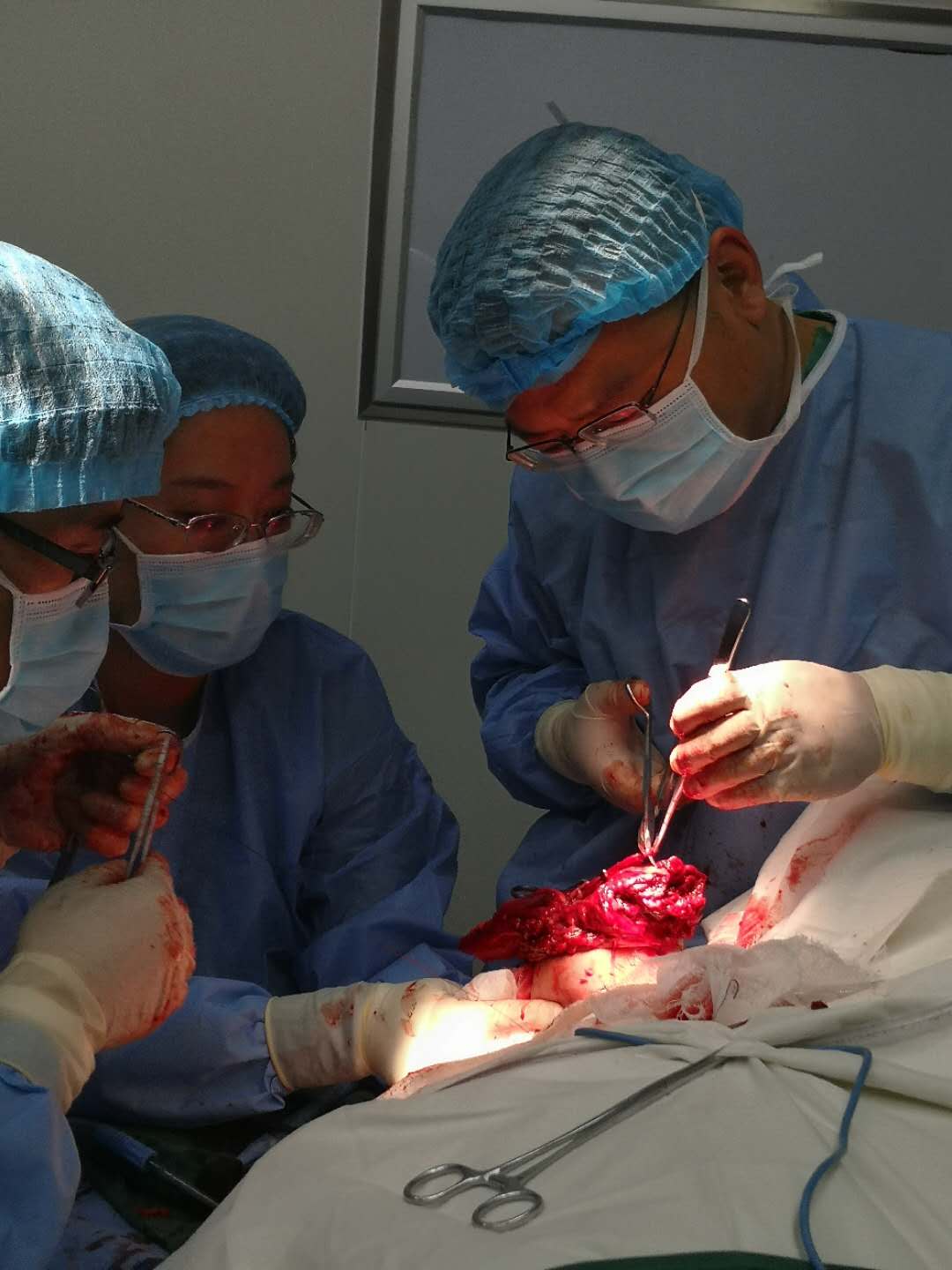 长岛首例！毓璜顶医院对口支援医疗队成功开展断臂再植手术