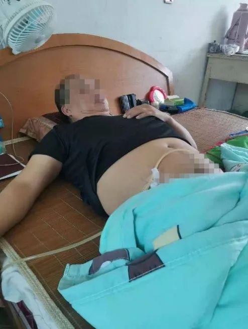合肥京东方医院：上门护理为卧床患者免去奔波之苦