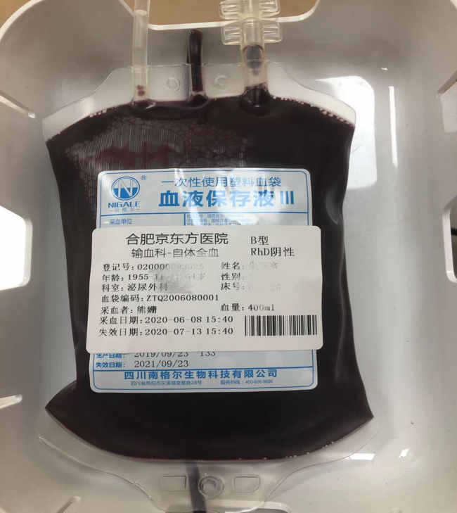 用自己的血救自己的命——合肥京东方医院首例「熊猫血」储存式自体输血顺利完成