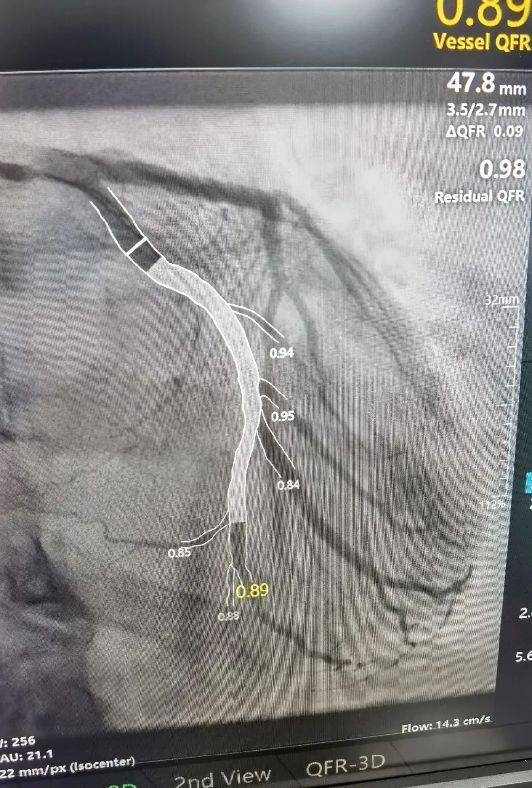 湖州市中心医院:砥砺奋进,书写学科发展「心」篇章