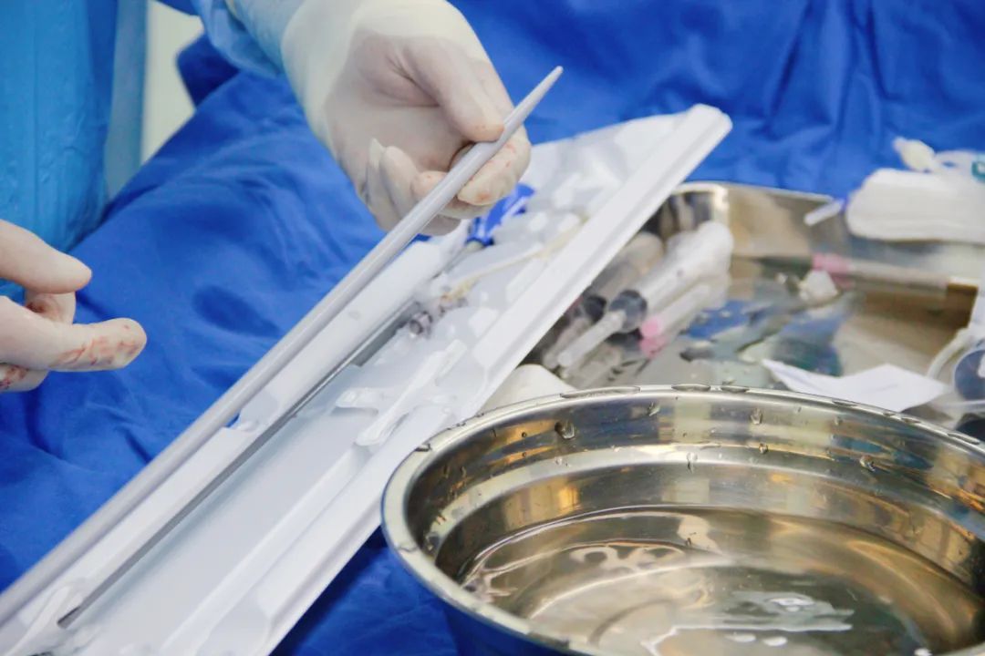 上海德达医院心血管内科成功植入院内首台无导线起搏器(Micra)