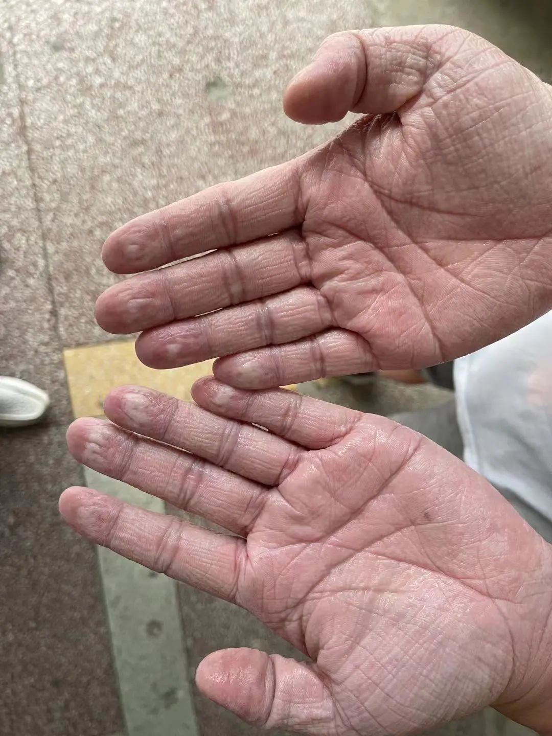 再出发！涵江医院第一批支援仙游医疗队转战厦门！