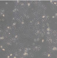  人永生化子宫内膜异位症患者在位内膜间质细胞hEM15A