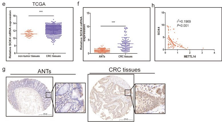 组蛋白修饰调控m6A修饰：METTL14抑制结直肠癌转移