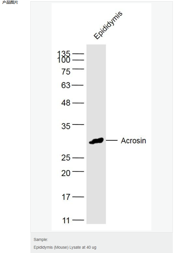 精子顶体前体蛋白抗体