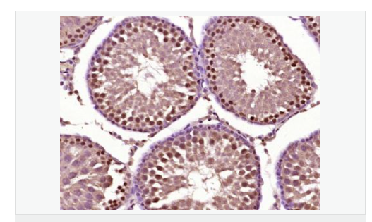 精子顶体前体蛋白抗体
