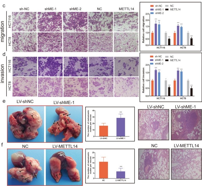 组蛋白修饰调控m6A修饰：METTL14抑制结直肠癌转移