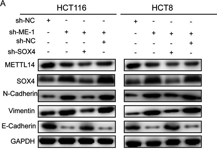 组蛋白修饰调控m6A修饰：METTL14抑制结直肠癌转移