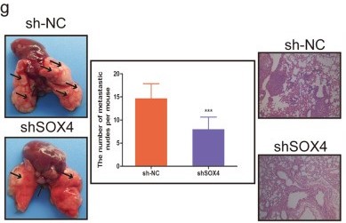 组蛋白修饰调控m6A修饰：METTL14抑制结直肠癌转移