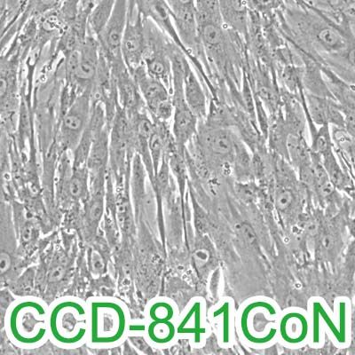 CCD-841CoN[CCD 841 CoN; CCD841CoN; CCD-841-CoN]人正常结肠组织细胞