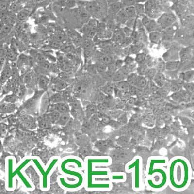 KYSE-150[KYSE 150; KY150]人食管鳞癌细胞