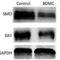 Western Blot（蛋白免疫印迹技术服务）