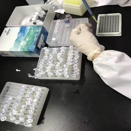 实验室人ELISA试剂盒无菌操作,你真的做到了吗?