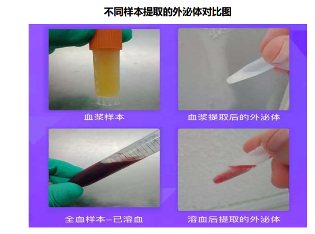 外泌体样本收集指南