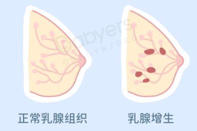 乳腺癌的这几种预警信号，你注意到了吗？